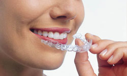 invisalign